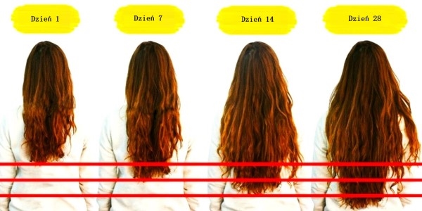 Domowe sposoby na porost włosów - 5 działających sposobów
